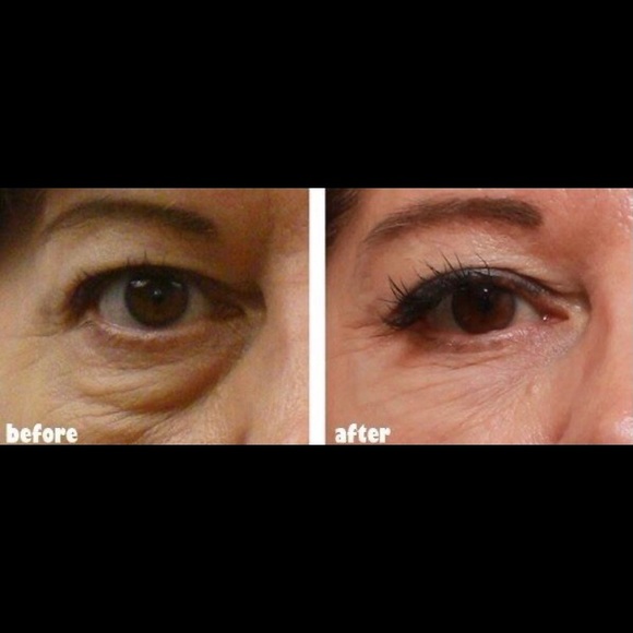 Eye Perfection - Picture 2 of 2